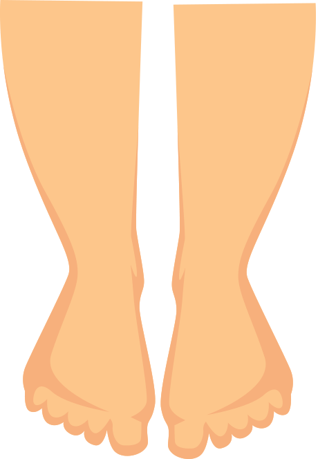 Anmessen von Kompressionsstrümpfen - Sinnvoll zu tragen bei geschwollenen Füßen und Fußknöcheln